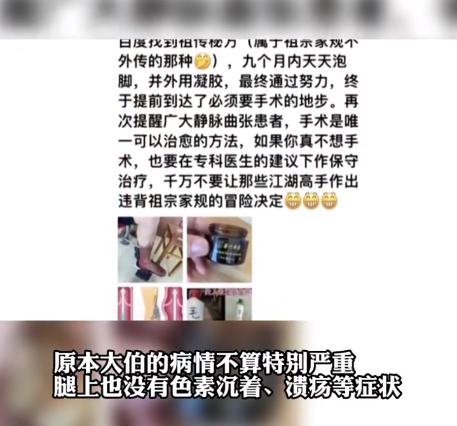 大爷泡脚治疗静脉曲张致双腿乌黑,每天泡脚治好了静脉曲张